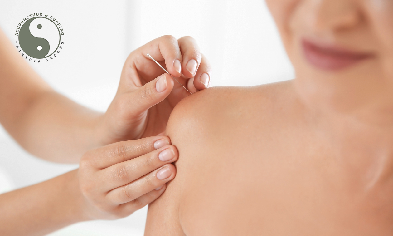 Acupunctuur & Cupping Patricia Jacobs